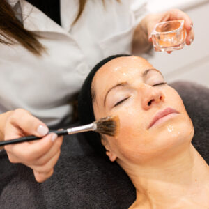 Chemical Peels Training
