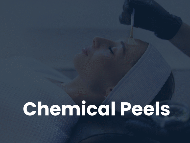 Mastering Chemical Peels