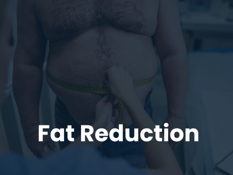 Fat Reduction Mastery