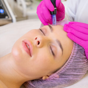 Microneedling Course