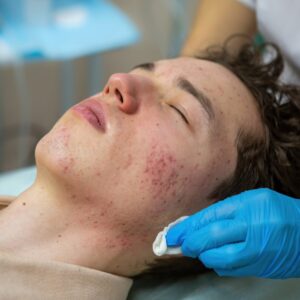 Subcision Online Course